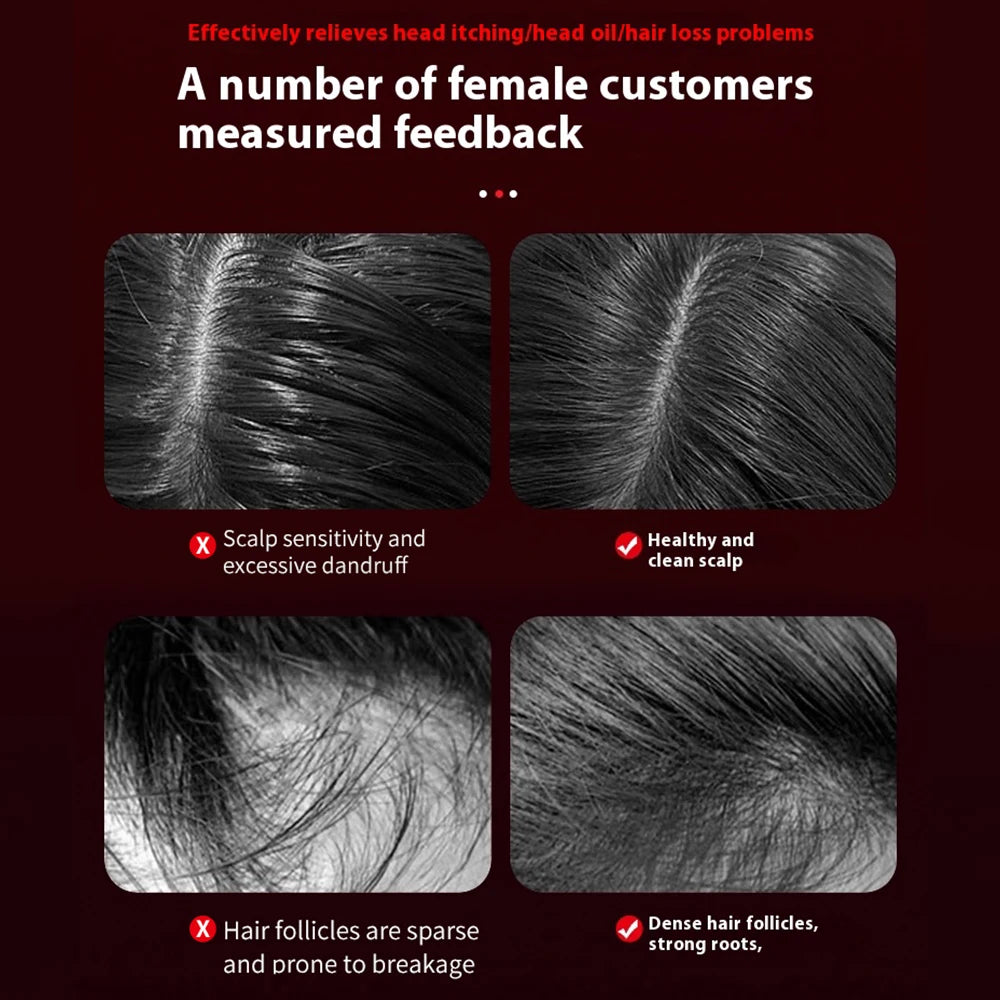 SoulScalp Red Light Massage Comb