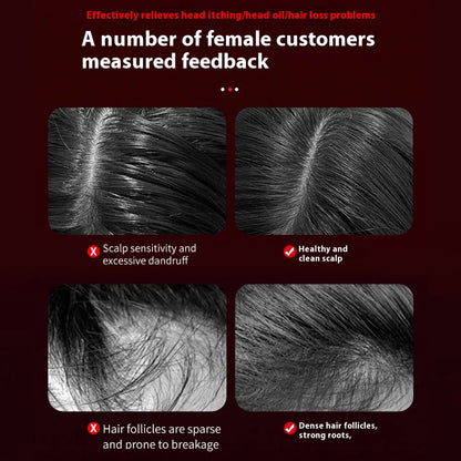 SoulScalp Red Light Massage Comb